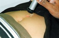 Laser acupuncture